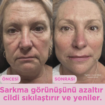 Sereluna™ – EMS Gıdı Kaldırma ve Ultraviyole Terapi Cihazı